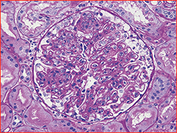 kidney biopsy image